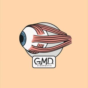 broche anatomía ojo lateral